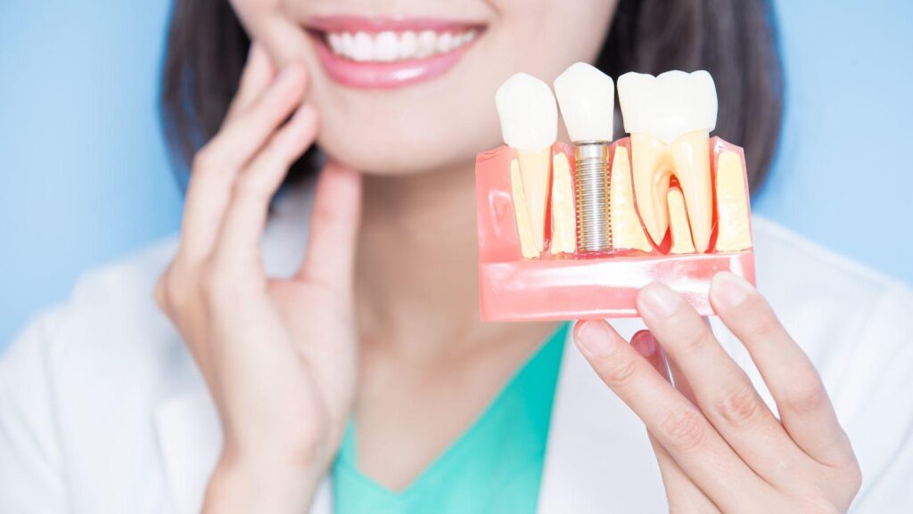 temporary teeth during implant healing, interim smile solutions, dental implant temporary options, implant healing teeth replacements, temporary dentures for implants, short-term implant teeth, replacement teeth during implant healing, interim dental prosthetics, implant recovery teeth options, temporary teeth bostons