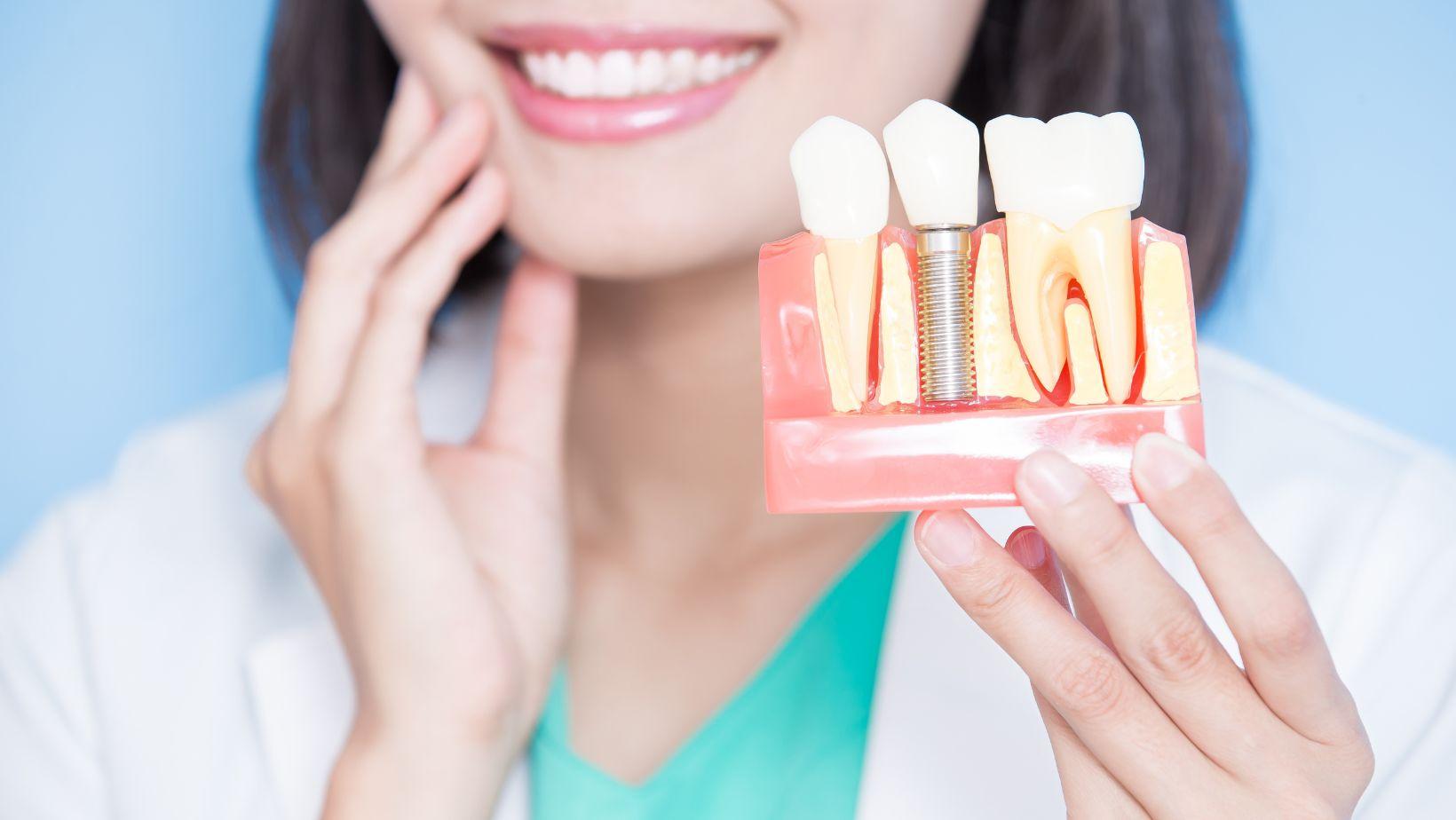 temporary teeth during implant healing, interim smile solutions, dental implant temporary options, implant healing teeth replacements, temporary dentures for implants, short-term implant teeth, replacement teeth during implant healing, interim dental prosthetics, implant recovery teeth options, temporary teeth bostons
